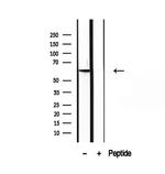 PIP5K1A Antibody in Western Blot (WB)