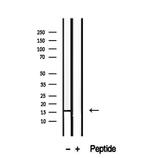 RPS14 Antibody in Western Blot (WB)