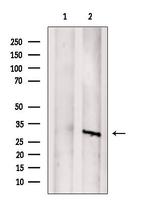 SAT1 Antibody in Western Blot (WB)