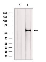 SLC13A2 Antibody in Western Blot (WB)