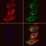 TBC1D23 Antibody in Immunocytochemistry (ICC/IF)