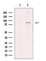 TBC1D23 Antibody in Western Blot (WB)