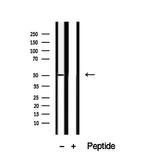 TRIM14 Antibody in Western Blot (WB)