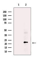 UBE2E2 Antibody in Western Blot (WB)