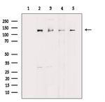 JMY Antibody in Western Blot (WB)