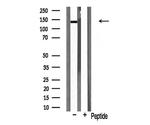 HGK Antibody in Western Blot (WB)