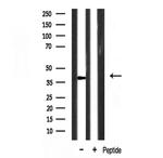 NR2F6 Antibody in Western Blot (WB)