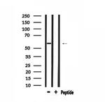 HARS Antibody in Western Blot (WB)