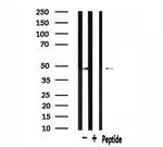 PRKAR2A Antibody in Western Blot (WB)