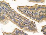 MARK3 Antibody in Immunohistochemistry (Paraffin) (IHC (P))