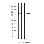 MARK3 Antibody in Western Blot (WB)