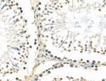 TEAD1 Antibody in Immunohistochemistry (Paraffin) (IHC (P))