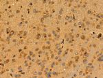 Cyclophilin F Antibody in Immunohistochemistry (Paraffin) (IHC (P))