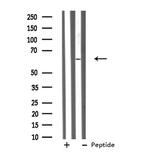 GRK4 Antibody in Western Blot (WB)