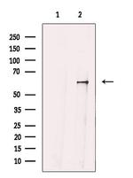 GRK4 Antibody in Western Blot (WB)