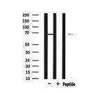 GRK5 Antibody in Western Blot (WB)