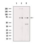 GRK5 Antibody in Western Blot (WB)