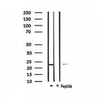 Recoverin Antibody in Western Blot (WB)