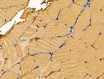 alpha Actinin 2/3 Antibody in Immunohistochemistry (Paraffin) (IHC (P))