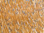 alpha Actinin 2/3 Antibody in Immunohistochemistry (Paraffin) (IHC (P))