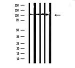 alpha Actinin 2/3 Antibody in Western Blot (WB)