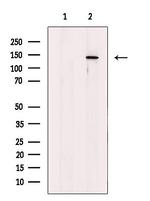 PHKA1/PHKA2 Antibody in Western Blot (WB)