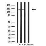 PHKA1/PHKA2 Antibody in Western Blot (WB)