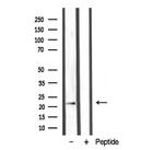 LTB Antibody in Western Blot (WB)