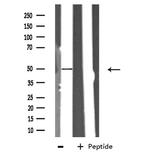 ITPK1 Antibody in Western Blot (WB)