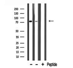 HLX Antibody in Western Blot (WB)