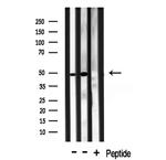 TRIP13 Antibody in Western Blot (WB)