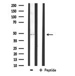 AGPAT9 Antibody in Western Blot (WB)