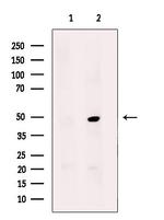 AGPAT9 Antibody in Western Blot (WB)