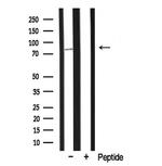 MARK2 Antibody in Western Blot (WB)