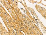 TUSC5 Antibody in Immunohistochemistry (Paraffin) (IHC (P))