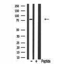 DCAMKL2 Antibody in Western Blot (WB)