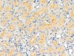 CABC1 Antibody in Immunohistochemistry (Paraffin) (IHC (P))