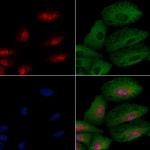 GTF3C2 Antibody in Immunocytochemistry (ICC/IF)