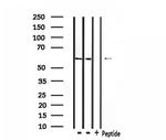 TAF15 Antibody in Western Blot (WB)