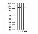 IARS2 Antibody in Western Blot (WB)