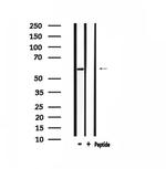 AATF Antibody in Western Blot (WB)