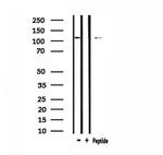 ZC3H7B Antibody in Western Blot (WB)