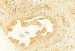 gamma Adducin Antibody in Immunohistochemistry (Paraffin) (IHC (P))