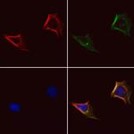 gamma Adducin Antibody in Immunocytochemistry (ICC/IF)