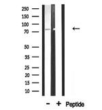 gamma Adducin Antibody in Western Blot (WB)