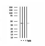 ARRDC3 Antibody in Western Blot (WB)