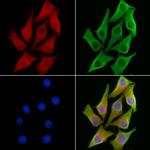 HCCS Antibody in Immunocytochemistry (ICC/IF)