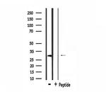 HCCS Antibody in Western Blot (WB)