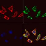 CDKAL1 Antibody in Immunocytochemistry (ICC/IF)