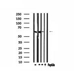 CDKAL1 Antibody in Western Blot (WB)